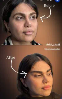 جراحی‌های صورت وبدن-اقساط