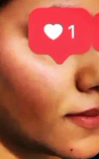تخلیه و تزریق چربی ساکشن شکم و پهلو غبغب