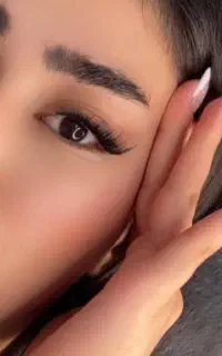 کاشت مژه
