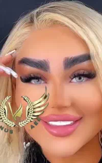 50% تخفیف تزریق ژل و بوتاکس مادلینگ عربی هایفو