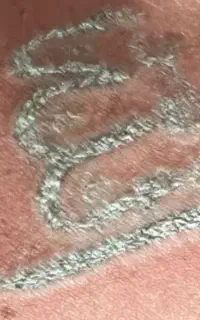 ریمو تتو و روشن سازی نواحی تیره