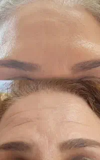 فوم شستشوی صورت