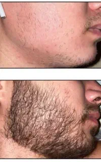 جوری ریش و مو در بیار که همه انگشت به دهن بمونن