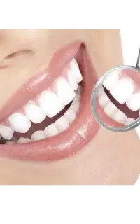 نیاز به مدل