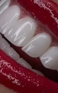 دندانپزشکی بدون پیش پرداخت