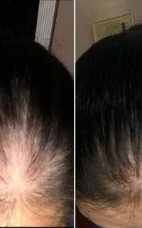 همش برطرف میشه