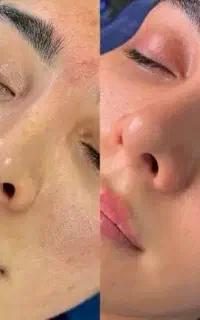 پاکسازی حرفه ای خانم ها و اقایان ۷۰۰