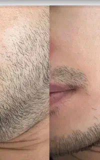 یکباراستفاده از محصول،یه عمر جذابیت