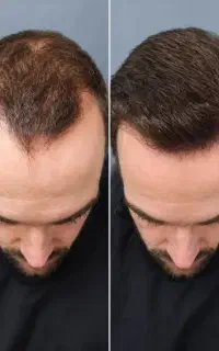 سیستم موهات درست کن