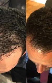موهات اعتصاب کردن، وقت مذاکره‌ست