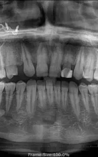 دندانپزشکی دندانسازی تخفیف ویژه ویزیت رایگان