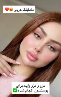 لیزر فول بادی ۹۸۰ پترو