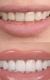 ارائه خدمات  دندانپزشکی با تخفیف ویژه