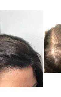 میتونی دوباره به دستش بیاری