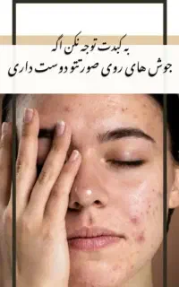 پاکسازی کبد چرب