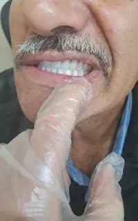 دندان سازی رامیار منبری سنندج