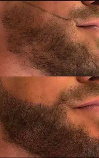 now face یک چهره جدید