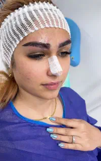 کاشت ابرو طبیعی تخفیف