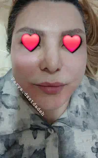 آف ویژه خدمات زیبایی