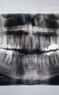 خدمات تخصصی دندانپزشکی/ درمان ، زیبایی و ایمپلنت