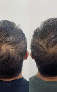 این اخرین روشیه که امتحان میکنی