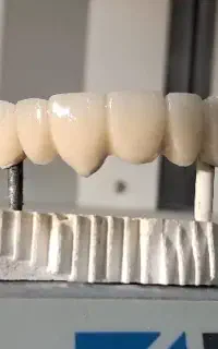کارآموز لابراتوار پروتزدندان