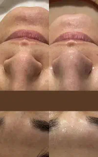 فیشال و مراقبت تخصصی پوست