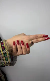 تخفیف کاشت 10 درصد به مناسبت عید قربان