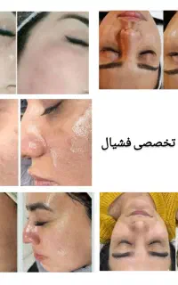 خدمات تخصصی فشیال و پاکسازی