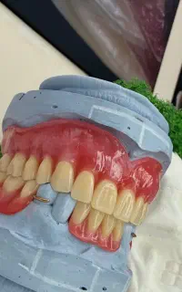 دوره اموزش پروتز دندان