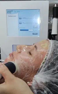 فیشیال تخصصی پوست پلاژن تراپی
