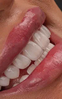 کلینیک دندانپزشکی /ایمپلنت / زیبایی
