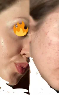 *بیوممتیک اورجینال*زیبایی پوستت رو دوباره کشف کن