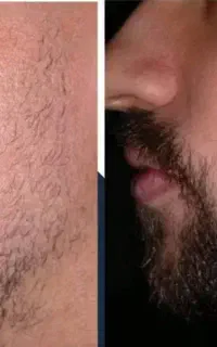 کاشت ممنوع