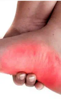 درمان بیماریها با طب سوزنی تضمینی