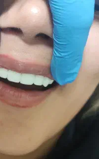 کلیه ی امور دندانپزشکی اقساطی