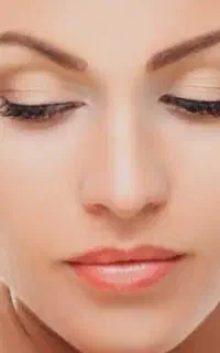 تخفیف عیدانه تزریق ژل و بوتاکس