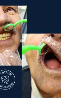 دندان‌سازی.مصنوعی‌تعمیرات‌.طبیعی.روکش.لمینت اقساط