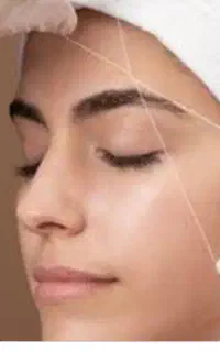 اسلاح صورت بابند۱۰۰