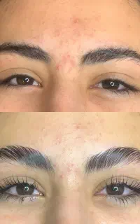 لیفت ابرو‌ لیفت مژه تخصصی