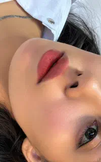 فیلر لب فقط ۱،۸۰۰،۰۰۰