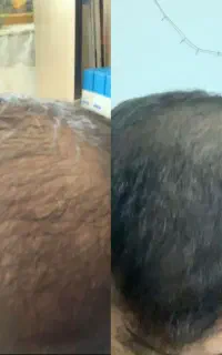 چاره ای برای تقویت موهای شما