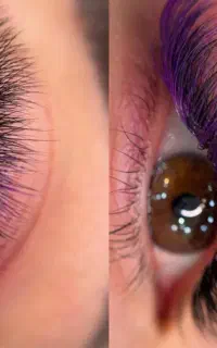 اگستنشن و لیفت