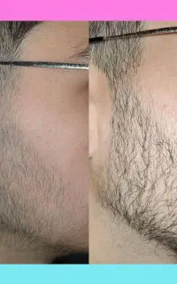 پسری که ریش نداره حق نداره بره خواستگاری