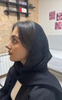 جشنواره زیبایی عمل بینی رینوپلاستی سیما سرچشمه