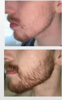 گندم زار میشه ریشات
