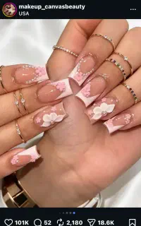 نیازمند مدل کاشت و ژلیش