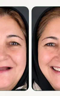 ساخت دندان مصنوعی با کیفیت و بادوام