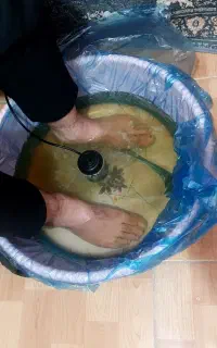 سم زدایی بدن با دستگاه یون تراپی