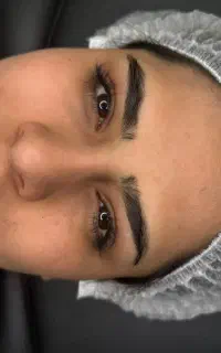 فیبروز میکروبلدینگ